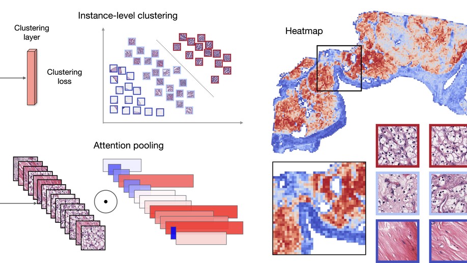 Data-efficient and weakly supervised computational pathology on whole-slide images